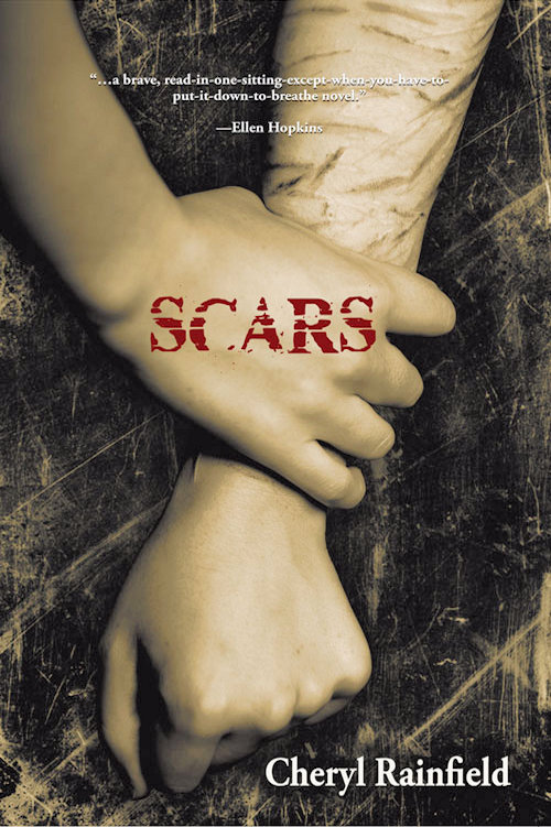 Scars